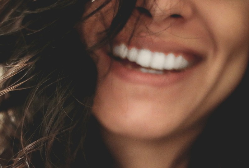 Close-up of healthy white teeth after Composite or Porcelain Veneers