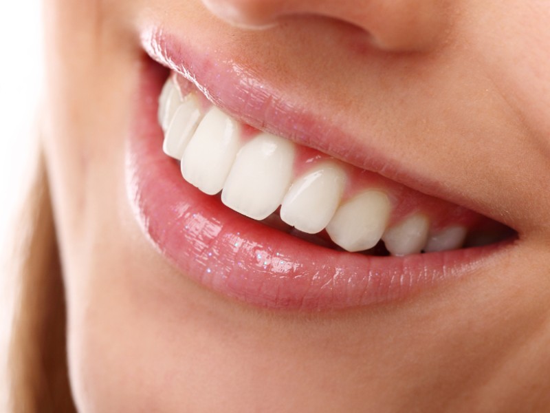 Bright white smile after professional cosmetic dentistry treatment