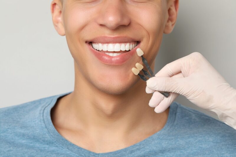 Dental Veneers in Flint