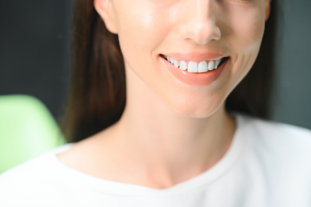 Dental Crowns in Southfield